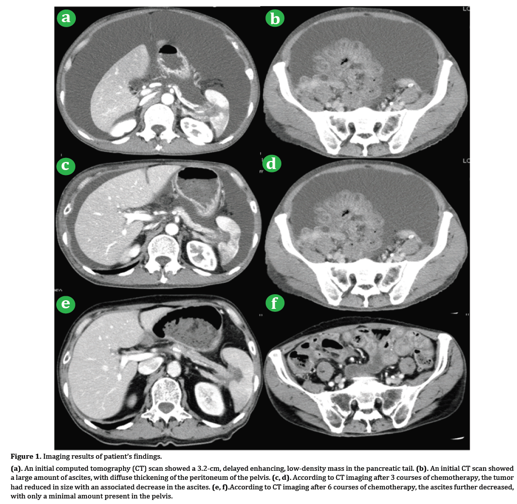 pancreas-imaging-results-patient