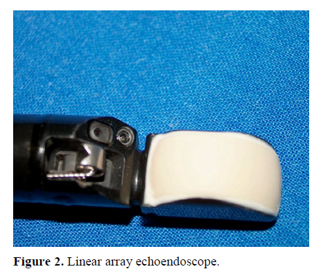 pancreas-linear-array-echoendoscope