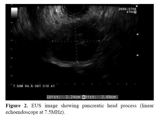 pancreas-linear-echoendoscope