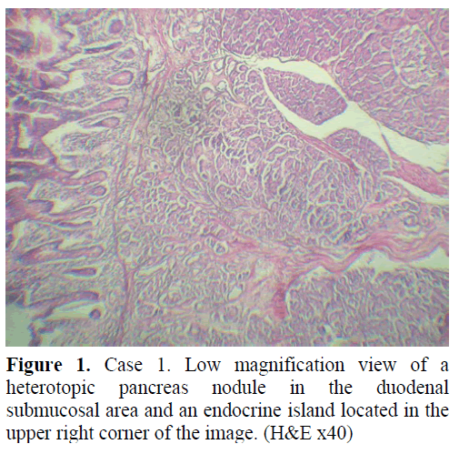 pancreas-low-magnification-view