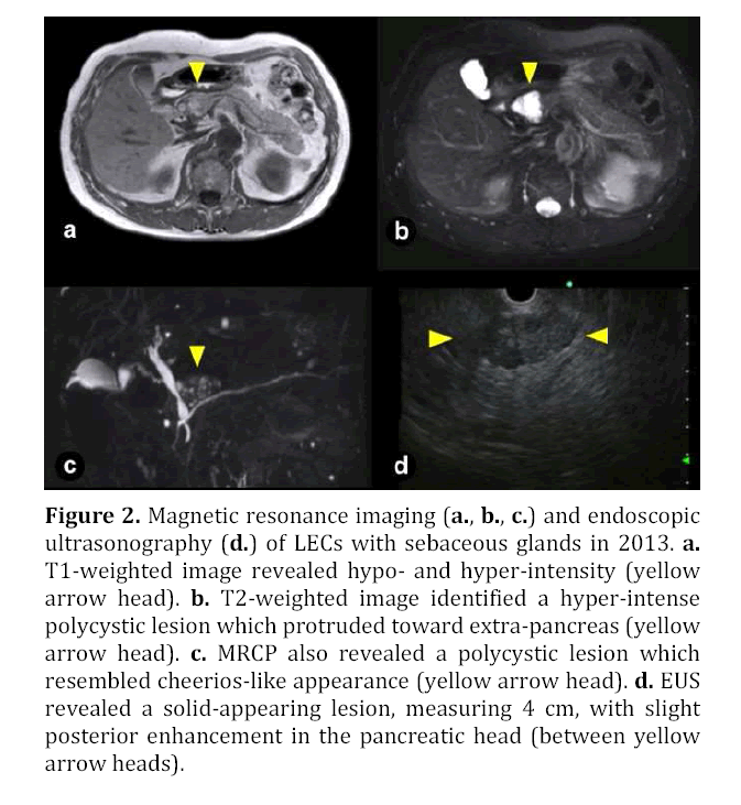 pancreas-magnetic-resonance-imaging