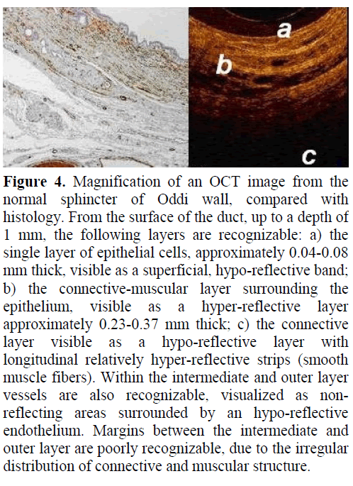 pancreas-magnification-oct-image-oddi-wall
