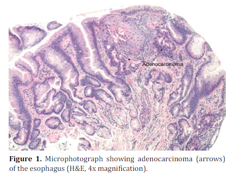 pancreas-microphotograph-esophagus