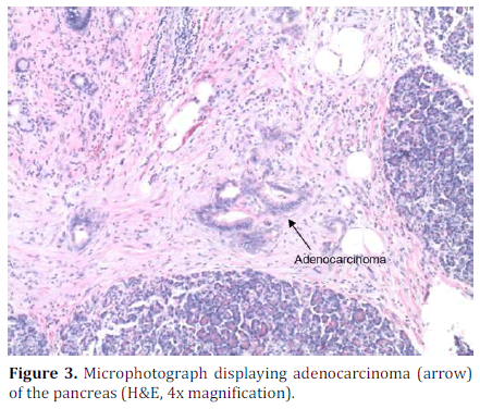 pancreas-microphotograph-pancreas