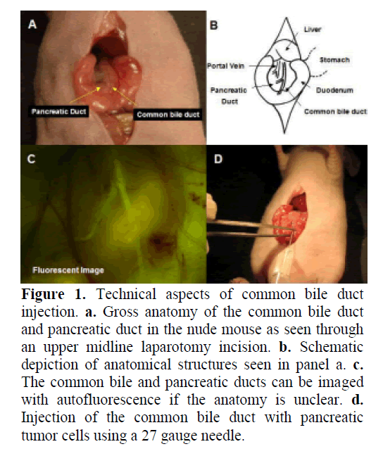 pancreas-midline-laparotomy-incision