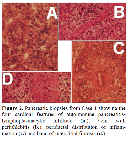 pancreas-pancreatic-biopsies-features