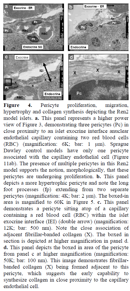 pancreas-pericyte-proliferation-migration