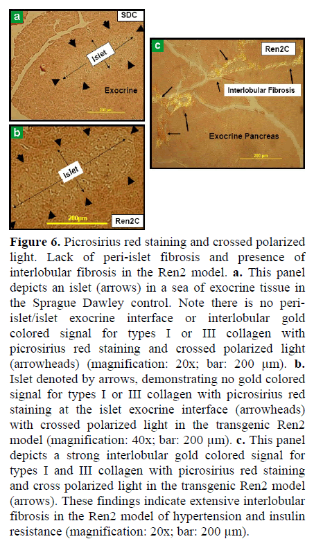 pancreas-picrosirius-red-staining-polarized