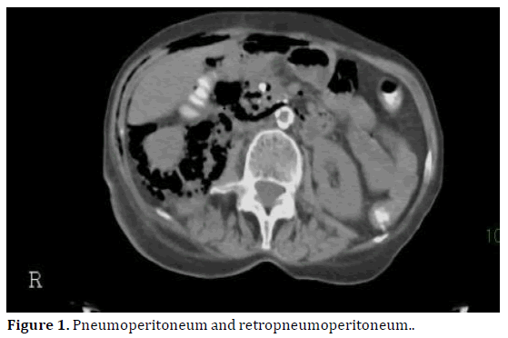 pancreas-pneumoperitoneum-retropneumoperitoneum