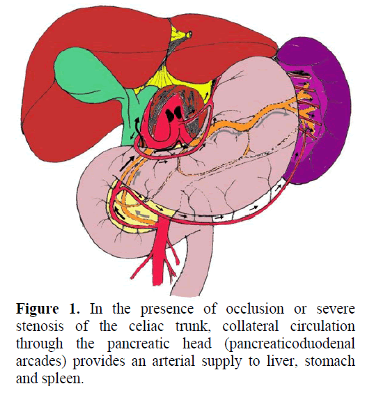 pancreas-presence-occlusion-stenosis