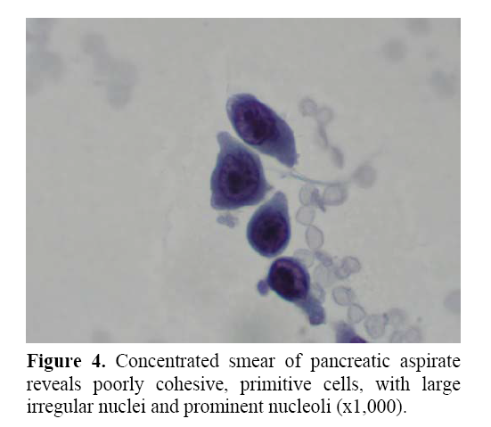 pancreas-prominent-nucleoli