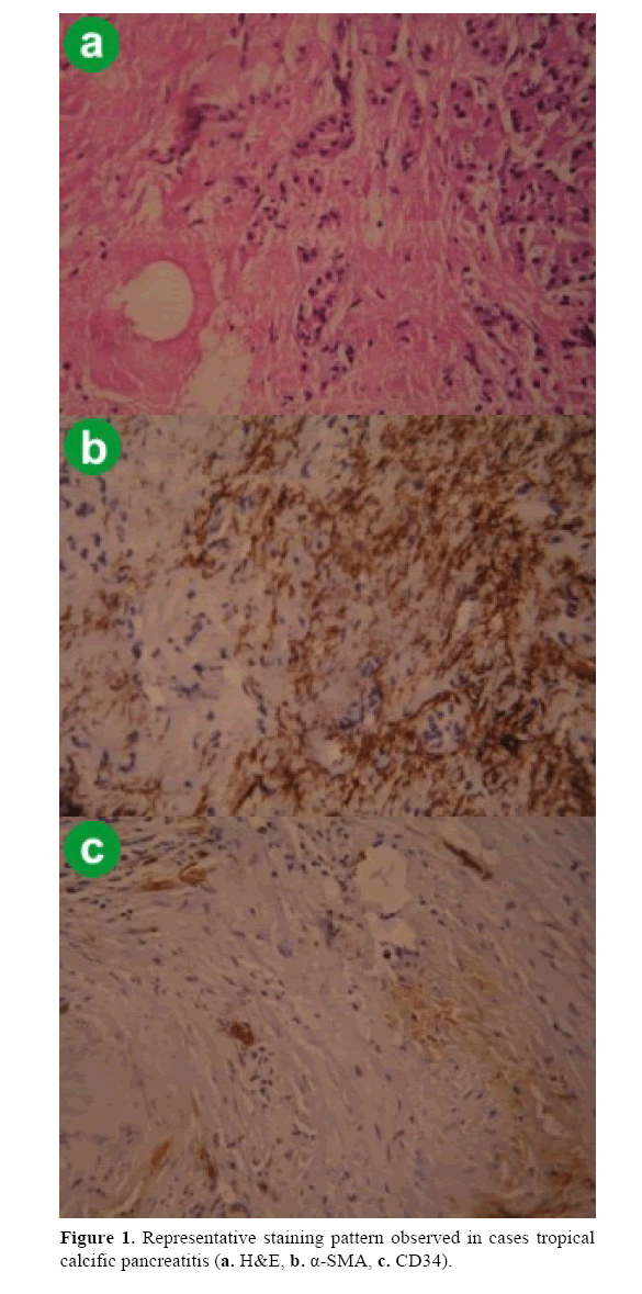 pancreas-representative-staining-pattern