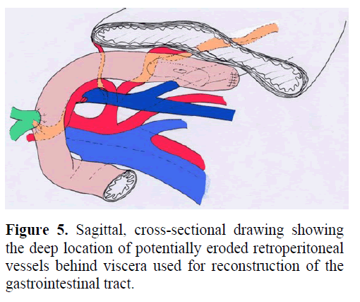 pancreas-sagittal-cross-sectional