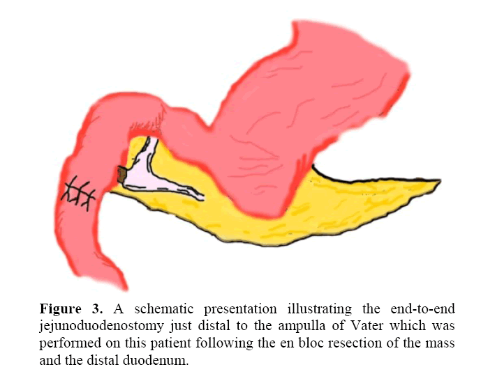 pancreas-schematic-presentation-illustrating