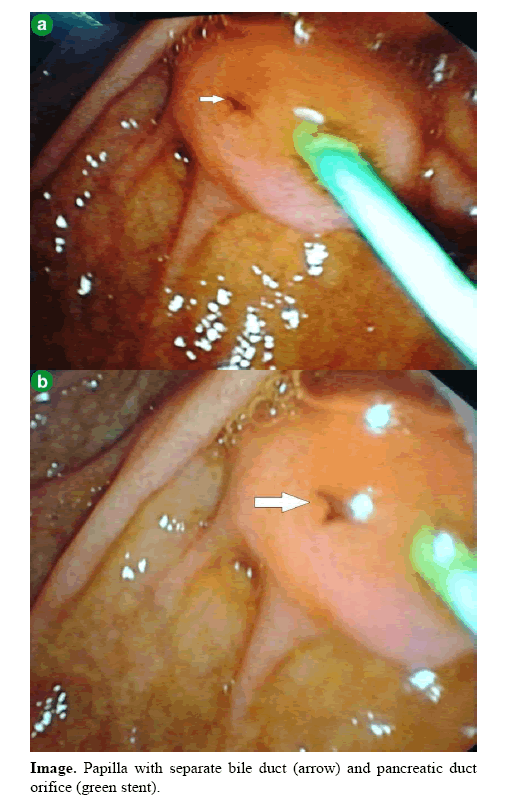 pancreas-separate-bile-duct