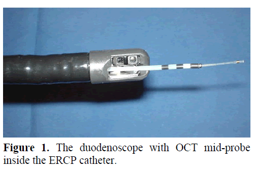pancreas-the-duodenoscope-oct-mid-probe