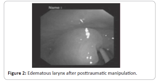 trauma-acute-care-larynx