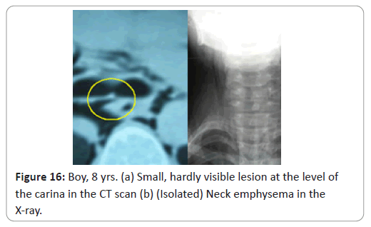 trauma-acute-care-lesion