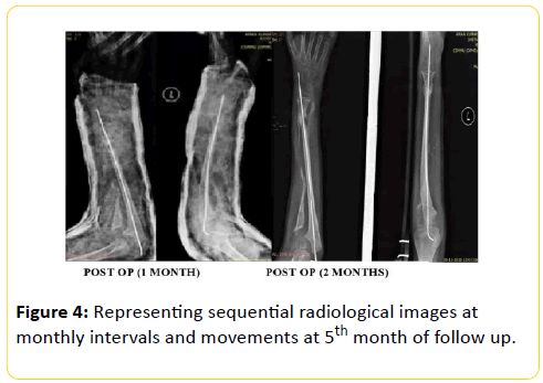 trauma-acute-care-radiological-images