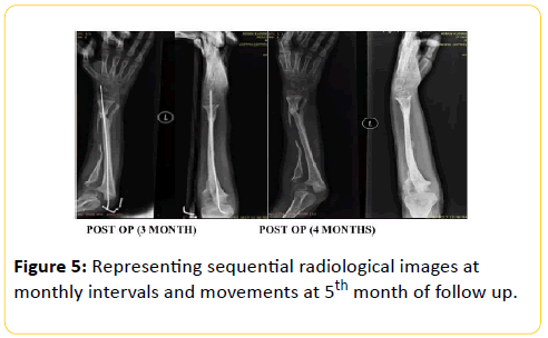 trauma-acute-care-radiological-images