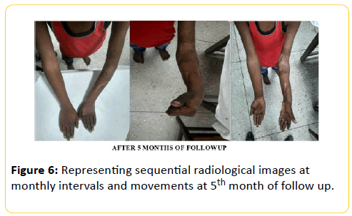 trauma-acute-care-sequential-radiological